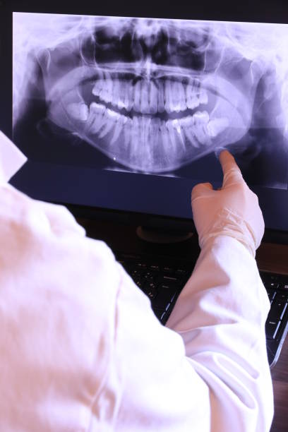 Best Emergency Root Canal Treatment in Berea, KY