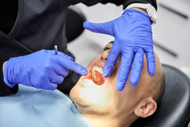 Best Emergency Tooth Extraction in Berea, KY